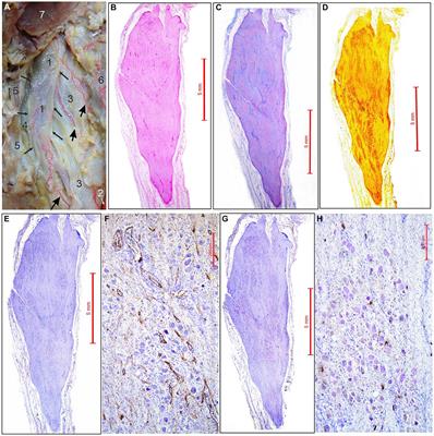 Arterial supply and morphological characteristics of sympathetic neurons in the human superior cervical ganglion